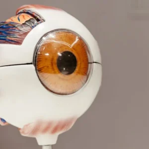 YAG Laser Course – 1-Day YAG Capsulotomy Training